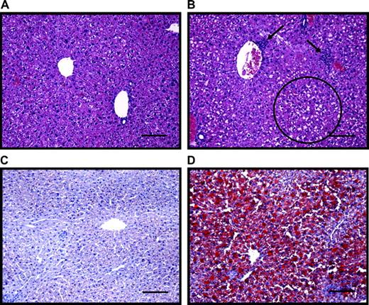 Liver histology from control and TCDD-treated mice at the 168-h time point. A and B are H&E stains from a control and TCDD-treated mouse, respectively. Arrows indicate immune cell accumulation; the circle highlights an area of extensive vacuolization. C and D are Oil Red O stains from a control and TCDD-treated mouse, respectively. Red-staining areas denote fat accumulation; bars = 10 μm.