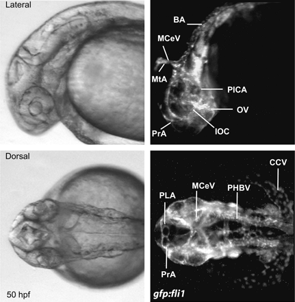 Visualization of the zebrafish embryo vasculature by gfp:fli1 expressing endothelial cells. Light and fluorescence microscopy of transgenic zebrafish embryos at 50 hfp in lateral and dorsal orientation. BA: basilar artery, CCV: common cardinal vein, IOC: inner optic circle, MCeV: middle cerebral vein, MtA: mesencephalic artery, OV: optic vein, PHBV: primordial hindbrain channel, PLA: palatocerebral artery, and PrA: prosencephalic artery.