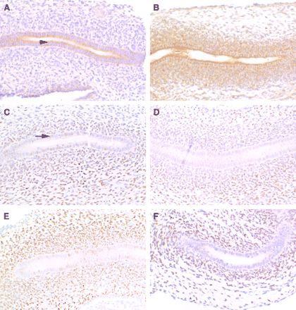 Immunolocalization of insulin-like growth factor 1 receptor (IGF1R) and androgen receptor (AR) in control (A, C) and DBP-exposed (B, D, E, F) fetuses on gestation day 19. Representative images shown are from the same region of the Wolffian duct (future corpus region) except for F (future cauda region). Epithelial cells lining the duct are surrounded by the condensing mesenchymal cells. All images were collected using 20× magnification. In control animals, IGF1R exhibited moderate cytoplasmic staining in the ductal epithelia (arrowhead, A), and with DBP-exposure there was more intense staining of the epithelial cells in addition to intense cytoplasmic staining of the mesenchyme (B). AR exhibited moderate nuclear staining of the ductal epithelial cells in control animals (arrow, C), and with DBP-exposure there was a decrease in ductal epithelial cell staining in the nucleus in some animals (D, F), but not as clearly in others (E). Nuclear AR staining of the mesenchyme was variable and did not change in Wolffian duct from DBP-exposed fetuses.