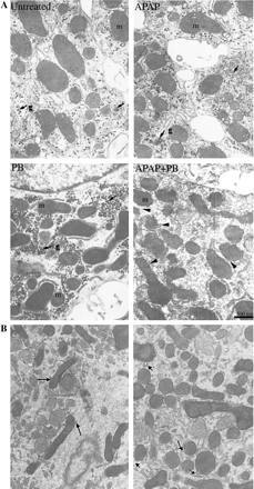 Effect of APAP and PB on ultrastructural changes in human hepatocytes. Hepatocytes from a single donor were treated for 24 h with 5 mM APAP, 2 mM PB, or their combination. Hepatocytes were fixed with 3% gluteraldehyde and processed for electron microscopy. Figure 4B shows more detailed changes in mitochondria morphology in two different culture sections in cells treated with the combination of APAP and PB. Images at 15K are shown. m—mitochondria; g—glucogen.