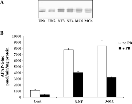 Inhibition of APAP-glucuronide formation by PB in rat liver microsomes. Liver microsomes from control or β-naphthoflavone (NF) or 3-methylcholanthrene (MC) treated rats were analyzed for expression of UDPGTs family (A). Microsomes were incubated with UDPGA and 5 mM APAP alone or in combination with 2 mM PB, and APAP-glucuronide formation was determined (B) as described under Materials and Methods. Each value represents the mean of duplicate incubations, with the range indicated by the vertical bars.