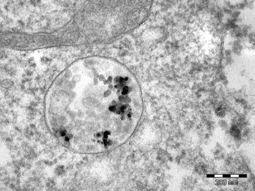 Aluminum nanoparticles inside an endosome of an A549 cell from an in vitro toxicity experiment.