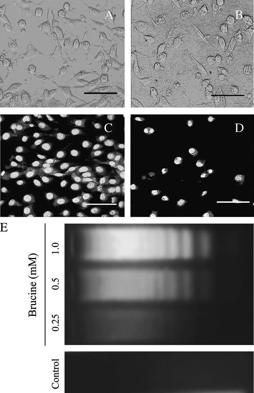 Brucine induced HepG2 cell death via apoptosis. Control cells (A) and brucine-treated cells (B) were observed under an inverted microscope; the cells morphology was photographed with a LM microscopy. For Hoechst 33258 staining, the control cells (C) and brucine- treated cells (D) were loaded with Hoechst 33258 (1 μg/ml) for 20 min and observed under a fluorescence microscope in less than 15 min; cells were treated with 0.5 mM brucine for 36 h (B, D). Scale bars, 50 μm. Dose-response effect of brucine on DNA fragmentations in HepG2 cells (E): cells after treatment for 36 h were lysed; the supernatant of the lysate was digested with 0.1 mg/ml proteinase K at 50°C for 60 min. The DNA was then extracted and resolved in a 1.8% agarose gel. Each experiment was performed in triplicate.