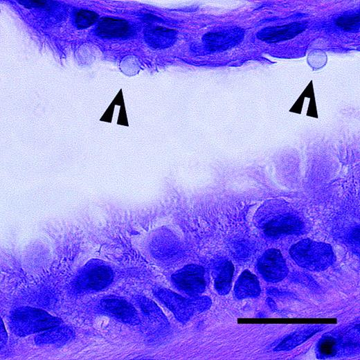 A section of a small airway in the rat lung with silica particles (arrowheads) deposited on the epithelium. The epithelium in the upper part of the image consists of a single ciliated cell layer. The epithelium in the lower part of the image is pseudostratified. Hematoxylin and eosin. Scale bar = 20 μm.
