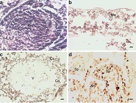 In situ hybridization of pine seedlings inoculated with Methylorubrum extorquens and controls 90 DPI. (A) Shoot tip meristem, (B) needle and (C) root tissue of an inoculated seedling hybridized with a probe specific for CUL1. (D) Shoot tip meristem of control seedling hybridized with a probe specific for CUL1. Am = apical meristem, Sp = scale primordium, Me = mesophyll, V = vascular tissue, Co = cortex and Cs = cylindrical sheath. Scale bar—20 μm.