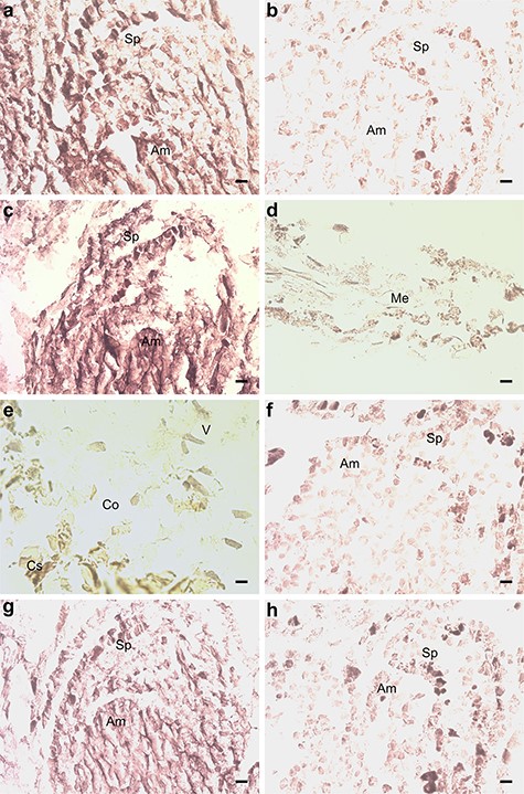 In situ hybridization of pine seedlings inoculated with Methylorubrum extorquens and controls 90 DPI. (A) Shoot tip meristem of an inoculated and (B) a control seedling, hybridized with a probe specific for the ETR2. (C) Shoot tip meristem, (D) needle and (E) root tissue of an inoculated seedling, hybridized with a probe specific for the ERF3. (F) Shoot tip meristem of a control seedling hybridized with a probe specific for the ERF3. (G) Shoot tip meristem of an inoculated and (H) a control seedling, hybridized with a probe specific for HYL1. Am = apical meristem, Sp = scale primordium, Me = mesophyll, V = vascular tissue, Co = cortex and Cs = cylindrical sheath. Scale bar—20 μm.