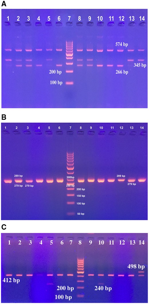 Gel stained with ethidium bromide showing the genotypes of (A) IL-1β-31, (B) IL1β -511 and (C) ILRN genes. (A) Lane 7: 100 bp DNA ladder; Lane 1, 5, 13, 14: IL1β-31 C/C genotype (345 and 574 bp); Lane 2, 3, 8, 9: IL1β-31 C/T genotype (266, 345 and 574 bp); Lane 4, 6, 10, 11, 12: IL1β-31 T/T genotype (266 and 574 bp). (B) Lane 7: 50 bp DNA ladder; Lane 1, 2, 4, 5, 6, 8, 9, 10: IL1β-511 C/T genotype (279 and 289 bp). Lane 3, 11, 13, 14: IL1β-511 C/C genotype (279 bp), and lane 12: IL1β-511 T/T genotype (289 bp). (C) Lane 8: 100 bp DNA ladder, Lane 5, 10: ILRN 2/4 (240 and 412 bp); lane 1-4, 6, 7, 9, 11-13: ILRN 4/4 (412 bp); lane 14: ILRN 4/5 (412 bp and 498 bp).