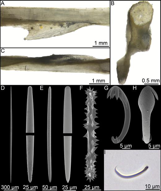 Cladorhiza kenchingtonae sp. nov. (A) Longitudinal section showing stem and filament, (B) cross section showing stem and two filaments, (C) longitudinal section of the distal part of the recovered fragment, (D) mycalostyle, (E) style, (F) acanthoxea, (G, H) anchorate anisochela side and back views, (I) sigmancistra microscope picture.
