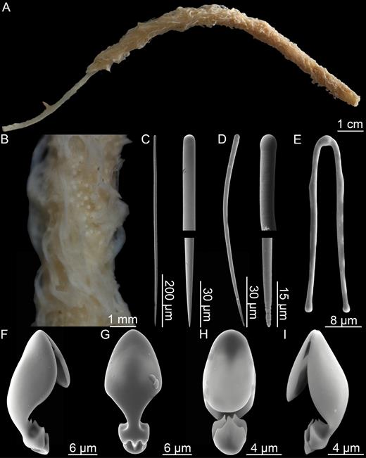 Lycopodina robusta. (A) Habit, (B) detail showing surface and embryos, (C) style, (D) tylostyle, (E) forceps spicule, (F, G) palmate anisochela 1, (H, I) embryonic palmate anisochela.