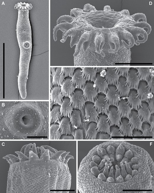 Gorgocephalus kyphosi, scanning electron micrographs. A, whole adult worm ex Kyphosus sydneyanus, Point Riley, Yorke Peninsula, South Australia. B, D, E, ventral sucker, oral sucker and tegument of A, respectively. C, oral sucker of adult worm ex Kyphosus cinerascens, Moreton Bay, Queensland, Australia. F, oral sucker of adult worm ex Kyphosus cinerascens, Rangiroa, Tuamotu Islands, French Polynesia. Scale bars: A, 400 μm; B, 30 μm; C, D, 50 μm; E, 10 μm; F, 40 μm.