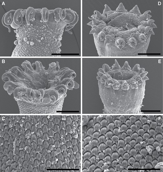 Gorgocephalus kyphosi and Gorgocephalus yaaji, ex Kyphosus vaigiensis, Lizard Island, Queensland, Australia, scanning electron micrographs. A, B, oral suckers of adult Gorgocephalus kyphosi. C, tegument of adult Gorgocephalus kyphosi. D, E, oral suckers of adult Gorgocephalus yaaji. F, tegument of adult Gorgocephalus yaaji. Scale bars: A, B, D, E, 50 μm; C, F, 20 μm.