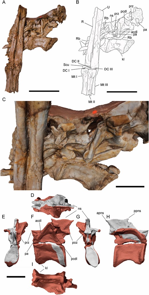 Posterior dorsal vertebrae and left forearm of Pelecanimimus (MCCM-LH 7777). A, B, isolated posterior dorsal vertebrae (Dv) and left forearm in anatomical position, photo (A), drawing (B). C, close-up view of the neural spine of the posterior dorsal vertebra. D–I, digital reconstruction of the posteriormost preserved dorsal vertebra in dorsal (D), anterior (E), lateral left (F), posterior (G), lateral right (H) and ventral (I) views with restored areas in grey. Abbreviations: acdl, anterocentrodiapophyseal lamina; acdl, anterior centrodiapophyseal lamina; apns, anterior process of neural spine; dp, diapophysis; DC, distal carpal; DRb, dorsal rib, kl, keel; Mc, metacarpal; ns, neural spine; pa, parapophysis; pn, pneumatic foramina; pcdl, posterior centrodiapophyseal lamina; pop, posterior process; poz, postzygapophysis; ppns, posterior process of neural spine; prz, prezygapophysis, R, radius; Rb, rib; Scu, scapholunare: U, ulna. Scale bars: A, B, 50 mm; C, 20 mm.