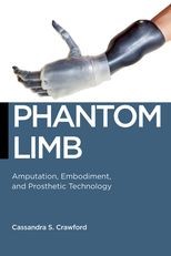 Phantom Limb: Amputation, Embodiment, and Prosthetic Technology
